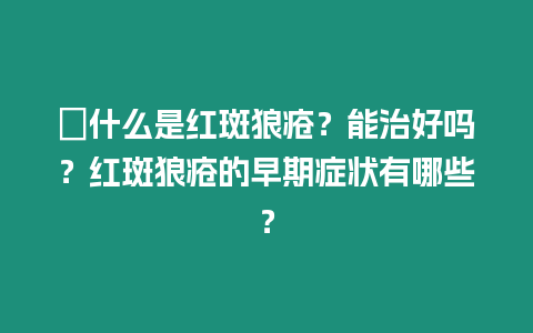 ?什么是紅斑狼瘡？能治好嗎？紅斑狼瘡的早期癥狀有哪些？